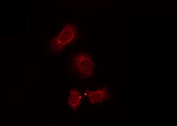 OR7E5P Antibody - Staining NIH-3T3 cells by IF/ICC. The samples were fixed with PFA and permeabilized in 0.1% Triton X-100, then blocked in 10% serum for 45 min at 25°C. The primary antibody was diluted at 1:200 and incubated with the sample for 1 hour at 37°C. An Alexa Fluor 594 conjugated goat anti-rabbit IgG (H+L) Ab, diluted at 1/600, was used as the secondary antibody.