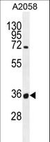 OR7G1 Antibody - OR7G1 Antibody western blot of A2058 cell line lysates (35 ug/lane). The OR7G1 antibody detected the OR7G1 protein (arrow).