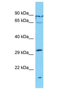 OR7G1 Antibody - OR7G1 antibody Western Blot of HT1080. Antibody dilution: 1 ug/ml.  This image was taken for the unconjugated form of this product. Other forms have not been tested.
