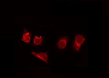 OR89 Antibody - Staining HepG2 cells by IF/ICC. The samples were fixed with PFA and permeabilized in 0.1% Triton X-100, then blocked in 10% serum for 45 min at 25°C. The primary antibody was diluted at 1:200 and incubated with the sample for 1 hour at 37°C. An Alexa Fluor 594 conjugated goat anti-rabbit IgG (H+L) Ab, diluted at 1/600, was used as the secondary antibody.