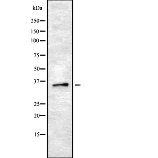 OR8B2+3 Antibody - Western blot analysis OR8B2/B3 using LOVO cells whole cells lysates
