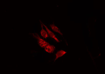 OR8B2+3 Antibody - Staining HeLa cells by IF/ICC. The samples were fixed with PFA and permeabilized in 0.1% Triton X-100, then blocked in 10% serum for 45 min at 25°C. The primary antibody was diluted at 1:200 and incubated with the sample for 1 hour at 37°C. An Alexa Fluor 594 conjugated goat anti-rabbit IgG (H+L) Ab, diluted at 1/600, was used as the secondary antibody.