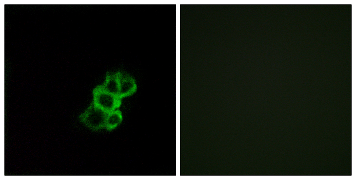 OR8B4 Antibody - Immunofluorescence analysis of MCF7 cells, using OR8B4 Antibody. The picture on the right is blocked with the synthesized peptide.