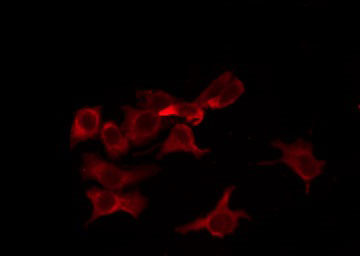 OR8B4 Antibody - Staining MCF-7 cells by IF/ICC. The samples were fixed with PFA and permeabilized in 0.1% Triton X-100, then blocked in 10% serum for 45 min at 25°C. The primary antibody was diluted at 1:200 and incubated with the sample for 1 hour at 37°C. An Alexa Fluor 594 conjugated goat anti-rabbit IgG (H+L) Ab, diluted at 1/600, was used as the secondary antibody.