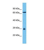 OR8D1 Antibody - Western blot of Human HeLa. OR8D1 antibody dilution 1.0 ug/ml.  This image was taken for the unconjugated form of this product. Other forms have not been tested.