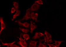 OR8D1 Antibody - Staining HeLa cells by IF/ICC. The samples were fixed with PFA and permeabilized in 0.1% Triton X-100, then blocked in 10% serum for 45 min at 25°C. The primary antibody was diluted at 1:200 and incubated with the sample for 1 hour at 37°C. An Alexa Fluor 594 conjugated goat anti-rabbit IgG (H+L) Ab, diluted at 1/600, was used as the secondary antibody.