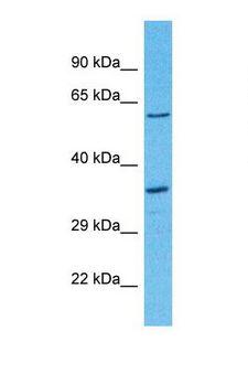 OR8D2 Antibody - Western blot of Human 721_B. OR8D2 antibody dilution 1.0 ug/ml.  This image was taken for the unconjugated form of this product. Other forms have not been tested.