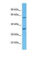OR8D2 Antibody - Western blot of Human 721_B. OR8D2 antibody dilution 1.0 ug/ml.  This image was taken for the unconjugated form of this product. Other forms have not been tested.