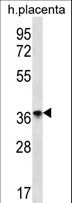 OR8D4 Antibody - OR8D4 Antibody western blot of human placenta tissue lysates (35 ug/lane). The OR8D4 antibody detected the OR8D4 protein (arrow).