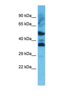 OR8D4 Antibody - Western blot of Human HepG2. OR8D4 antibody dilution 1.0 ug/ml.  This image was taken for the unconjugated form of this product. Other forms have not been tested.