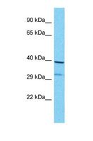 OR8G1 Antibody - Western blot of Human MCF7. OR8G1 antibody dilution 1.0 ug/ml.  This image was taken for the unconjugated form of this product. Other forms have not been tested.