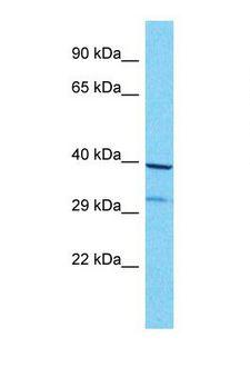 OR8G1 Antibody - Western blot of Human MCF7. OR8G1 antibody dilution 1.0 ug/ml.  This image was taken for the unconjugated form of this product. Other forms have not been tested.