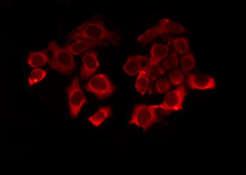 OR8G2 Antibody - Staining HT29 cells by IF/ICC. The samples were fixed with PFA and permeabilized in 0.1% Triton X-100, then blocked in 10% serum for 45 min at 25°C. The primary antibody was diluted at 1:200 and incubated with the sample for 1 hour at 37°C. An Alexa Fluor 594 conjugated goat anti-rabbit IgG (H+L) Ab, diluted at 1/600, was used as the secondary antibody.