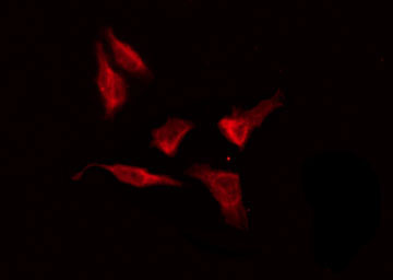 OR8G5 Antibody - Staining HeLa cells by IF/ICC. The samples were fixed with PFA and permeabilized in 0.1% Triton X-100, then blocked in 10% serum for 45 min at 25°C. The primary antibody was diluted at 1:200 and incubated with the sample for 1 hour at 37°C. An Alexa Fluor 594 conjugated goat anti-rabbit IgG (H+L) Ab, diluted at 1/600, was used as the secondary antibody.
