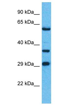 OR8H1 Antibody - OR8H1 antibody Western Blot of Jurkat. Antibody dilution: 1 ug/ml.  This image was taken for the unconjugated form of this product. Other forms have not been tested.