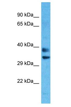 OR8H1 Antibody - OR8H1 antibody Western Blot of HepG2. Antibody dilution: 1 ug/ml.  This image was taken for the unconjugated form of this product. Other forms have not been tested.