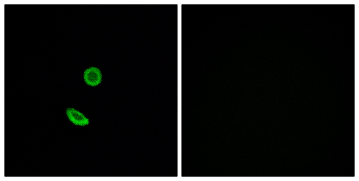 OR8H2 Antibody - Immunofluorescence analysis of A549 cells, using OR8H2 Antibody. The picture on the right is blocked with the synthesized peptide.