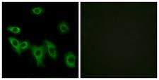 OR8H3 Antibody - Immunofluorescence analysis of HUVEC cells, using OR8H3 Antibody. The picture on the right is blocked with the synthesized peptide.