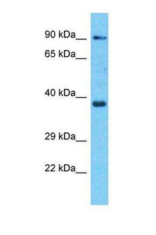 OR8H3 Antibody - Western blot of Human A549. OR8H3 antibody dilution 1.0 ug/ml.  This image was taken for the unconjugated form of this product. Other forms have not been tested.