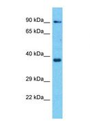 OR8H3 Antibody - Western blot of Human A549. OR8H3 antibody dilution 1.0 ug/ml.  This image was taken for the unconjugated form of this product. Other forms have not been tested.
