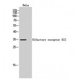 OR8I2 Antibody - Western blot of Olfactory receptor 8I2 antibody
