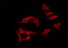 OR8I2 Antibody - Staining HeLa cells by IF/ICC. The samples were fixed with PFA and permeabilized in 0.1% Triton X-100, then blocked in 10% serum for 45 min at 25°C. The primary antibody was diluted at 1:200 and incubated with the sample for 1 hour at 37°C. An Alexa Fluor 594 conjugated goat anti-rabbit IgG (H+L) Ab, diluted at 1/600, was used as the secondary antibody.