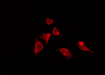 OR8J3 Antibody - Staining HeLa cells by IF/ICC. The samples were fixed with PFA and permeabilized in 0.1% Triton X-100, then blocked in 10% serum for 45 min at 25°C. The primary antibody was diluted at 1:200 and incubated with the sample for 1 hour at 37°C. An Alexa Fluor 594 conjugated goat anti-rabbit IgG (H+L) Ab, diluted at 1/600, was used as the secondary antibody.