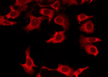 OR8K3 Antibody - Staining LOVO cells by IF/ICC. The samples were fixed with PFA and permeabilized in 0.1% Triton X-100, then blocked in 10% serum for 45 min at 25°C. The primary antibody was diluted at 1:200 and incubated with the sample for 1 hour at 37°C. An Alexa Fluor 594 conjugated goat anti-rabbit IgG (H+L) Ab, diluted at 1/600, was used as the secondary antibody.