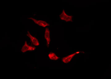 OR8S1 Antibody - Staining HT29 cells by IF/ICC. The samples were fixed with PFA and permeabilized in 0.1% Triton X-100, then blocked in 10% serum for 45 min at 25°C. The primary antibody was diluted at 1:200 and incubated with the sample for 1 hour at 37°C. An Alexa Fluor 594 conjugated goat anti-rabbit IgG (H+L) Ab, diluted at 1/600, was used as the secondary antibody.