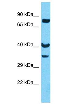 OR8U8 Antibody - OR8U8 antibody Western Blot of 721_B. Antibody dilution: 1 ug/ml.  This image was taken for the unconjugated form of this product. Other forms have not been tested.