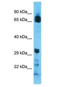 OR8U9 Antibody - OR8U9 antibody Western Blot of ACHN. Antibody dilution: 1 ug/ml.  This image was taken for the unconjugated form of this product. Other forms have not been tested.