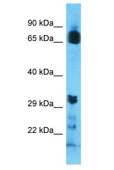 OR8U9 Antibody - OR8U9 antibody Western Blot of ACHN. Antibody dilution: 1 ug/ml.  This image was taken for the unconjugated form of this product. Other forms have not been tested.
