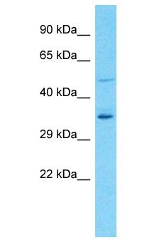 OR8U9 Antibody - OR8U9 antibody Western Blot of HeLa. Antibody dilution: 1 ug/ml.  This image was taken for the unconjugated form of this product. Other forms have not been tested.
