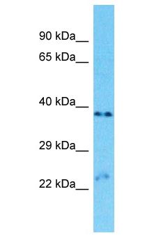 OR9A2 Antibody - OR9A2 antibody Western Blot of ACHN. Antibody dilution: 1 ug/ml.  This image was taken for the unconjugated form of this product. Other forms have not been tested.