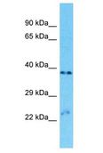 OR9A2 Antibody - OR9A2 antibody Western Blot of ACHN. Antibody dilution: 1 ug/ml.  This image was taken for the unconjugated form of this product. Other forms have not been tested.