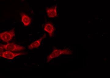 OR9A2 Antibody - Staining HuvEc cells by IF/ICC. The samples were fixed with PFA and permeabilized in 0.1% Triton X-100, then blocked in 10% serum for 45 min at 25°C. The primary antibody was diluted at 1:200 and incubated with the sample for 1 hour at 37°C. An Alexa Fluor 594 conjugated goat anti-rabbit IgG (H+L) Ab, diluted at 1/600, was used as the secondary antibody.