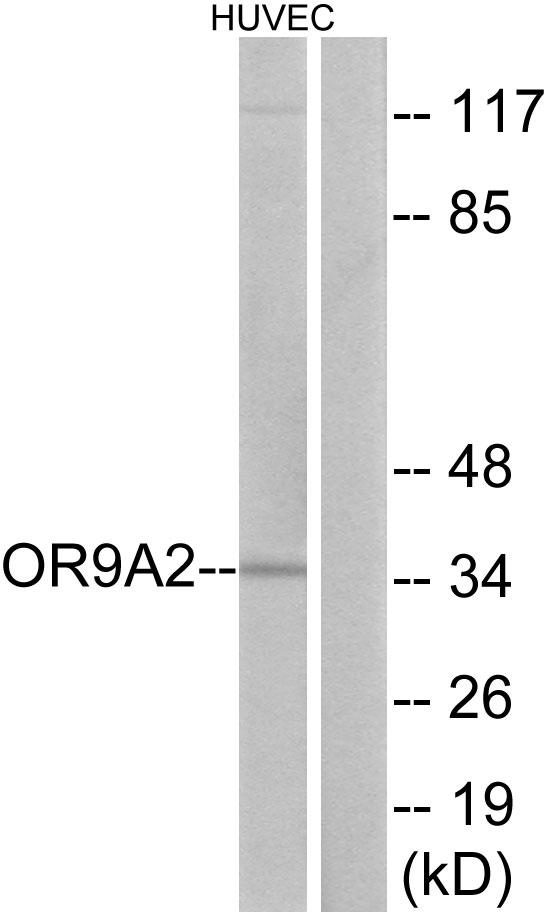 OR9A2 Antibody - Western blot analysis of extracts from HUVEC cells, using OR9A2 antibody.