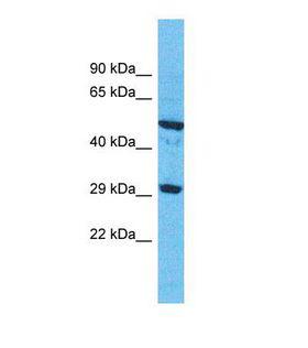 OR9G1 Antibody - Western blot of Human Fetal Kidney. OR9G1 antibody dilution 1.0 ug/ml.  This image was taken for the unconjugated form of this product. Other forms have not been tested.