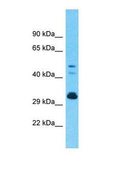 OR9G1 Antibody - Western blot of Human Fetal Kidney. OR9G1 antibody dilution 1.0 ug/ml.  This image was taken for the unconjugated form of this product. Other forms have not been tested.