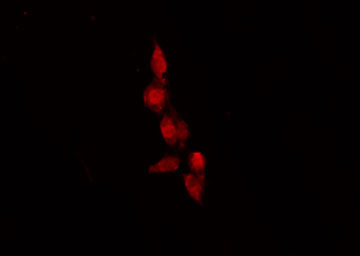 OR9G1 Antibody - Staining HeLa cells by IF/ICC. The samples were fixed with PFA and permeabilized in 0.1% Triton X-100, then blocked in 10% serum for 45 min at 25°C. The primary antibody was diluted at 1:200 and incubated with the sample for 1 hour at 37°C. An Alexa Fluor 594 conjugated goat anti-rabbit IgG (H+L) Ab, diluted at 1/600, was used as the secondary antibody.