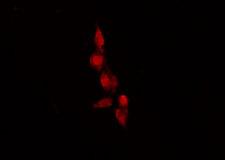 OR9G1 Antibody - Staining HeLa cells by IF/ICC. The samples were fixed with PFA and permeabilized in 0.1% Triton X-100, then blocked in 10% serum for 45 min at 25°C. The primary antibody was diluted at 1:200 and incubated with the sample for 1 hour at 37°C. An Alexa Fluor 594 conjugated goat anti-rabbit IgG (H+L) Ab, diluted at 1/600, was used as the secondary antibody.