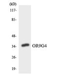 OR9G4 Antibody - Western blot analysis of the lysates from HeLa cells using OR9G4 antibody.