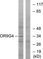 OR9G4 Antibody - Western blot analysis of lysates from HeLa cells, using OR9G4 Antibody. The lane on the right is blocked with the synthesized peptide.