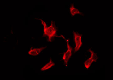 OR9G4 Antibody - Staining HeLa cells by IF/ICC. The samples were fixed with PFA and permeabilized in 0.1% Triton X-100, then blocked in 10% serum for 45 min at 25°C. The primary antibody was diluted at 1:200 and incubated with the sample for 1 hour at 37°C. An Alexa Fluor 594 conjugated goat anti-rabbit IgG (H+L) Ab, diluted at 1/600, was used as the secondary antibody.