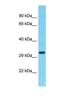 OR9G9 Antibody - Western blot of Human Fetal Kidney. OR9G9 antibody dilution 1.0 ug/ml.  This image was taken for the unconjugated form of this product. Other forms have not been tested.