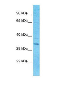 OR9I1 Antibody - Western blot of Human Fetal Kidney. OR9I1 antibody dilution 1.0 ug/ml.  This image was taken for the unconjugated form of this product. Other forms have not been tested.