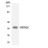 OR9Q1 Antibody - Western blot analysis of the lysates from HeLa cells using OR9Q1 antibody.