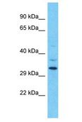 OR9Q1 Antibody - OR9Q1 antibody Western Blot of HT1080. Antibody dilution: 1 ug/ml.  This image was taken for the unconjugated form of this product. Other forms have not been tested.