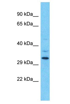 OR9Q1 Antibody - OR9Q1 antibody Western Blot of HT1080. Antibody dilution: 1 ug/ml.  This image was taken for the unconjugated form of this product. Other forms have not been tested.