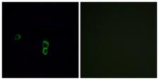 OR9Q1 Antibody - Immunofluorescence analysis of MCF7 cells, using OR9Q1 Antibody. The picture on the right is blocked with the synthesized peptide.